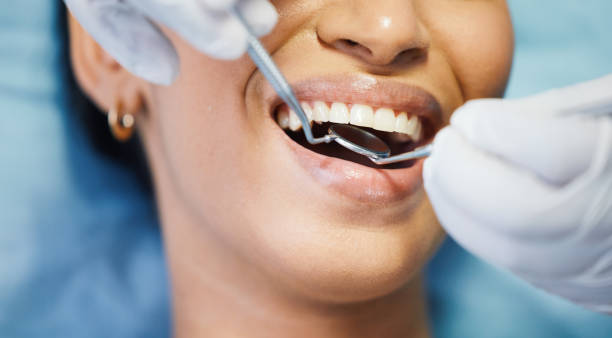 Best Dentist for Tooth Abscess  in Riverdale, UT